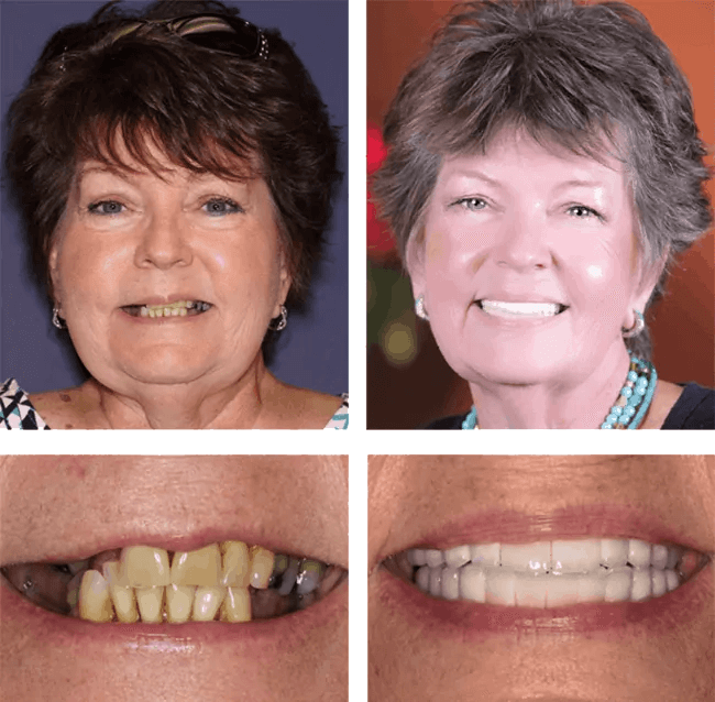 Linda's before after image