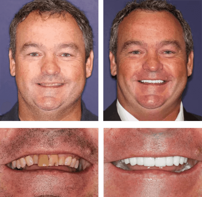 Tim's before after image