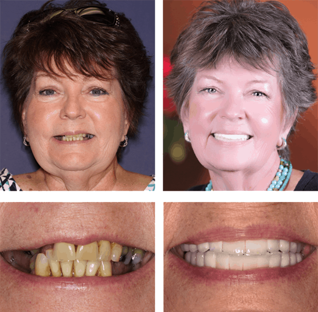 Linda's before after image