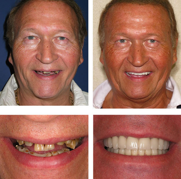 Welcome To Your Smile Transformation Journey