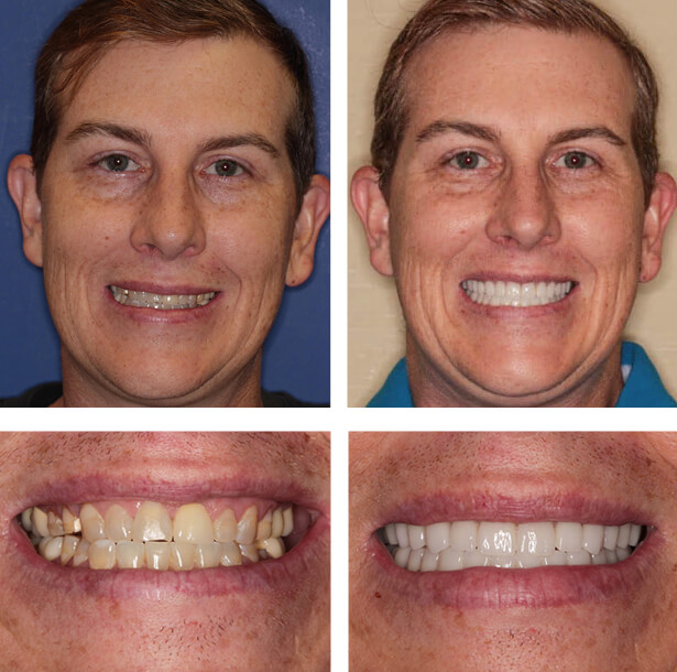 Embark On Your Smile Makeover